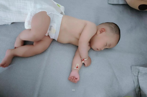 义乌宝宝脸上有白色斑块